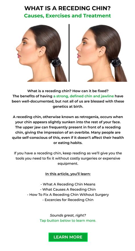 cghjn|Receding Chin: Pictures, Causes, Exercises, and Surgery.
